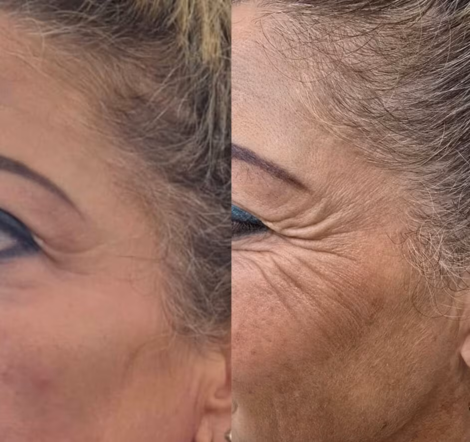 שופר גלריה - עבודת פיור סקין